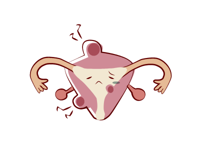 子宮筋腫